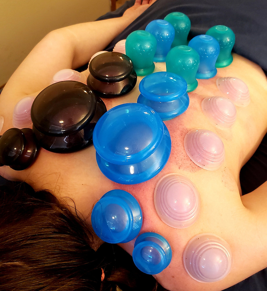 How Cupping Work Level Up Your Practice With Cupping