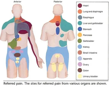Visceral Referred Pain Map