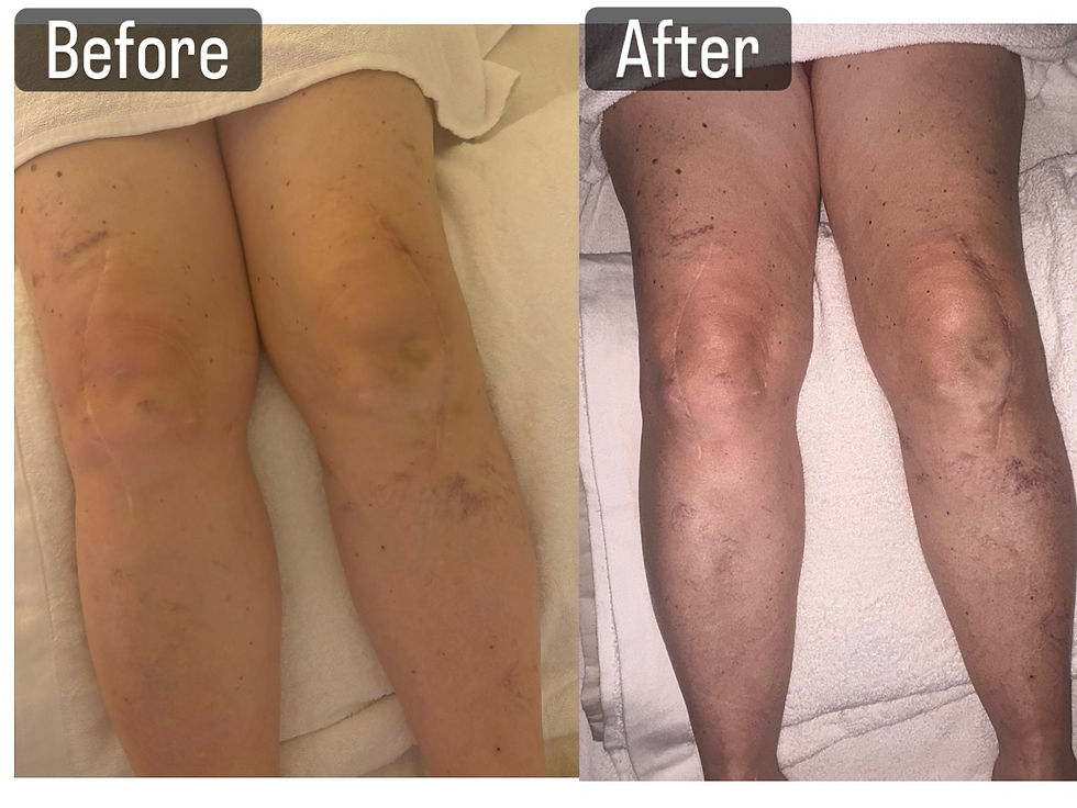 Close-up view of a therapist performing lymphatic drainage massage on a patient's arm