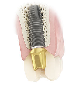 Zahnärztin Dr. Joos Zahnarzt Dr. Kreller Halensee Wilmersdorf Charlottenburg Berlin Zahnarztpraxis Westfälische Straße