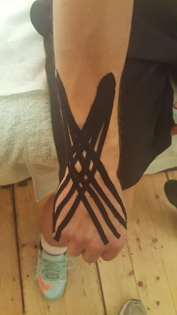 kinesio taping arm