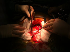 A Surgeon is Born