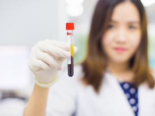 Homocysteine May Be the Most Ignored Blood Test That Can Save Your Life