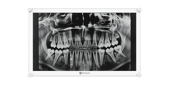 AG neovo DR-2202 Dental LCD monitor X Ray image
