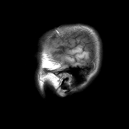 AFB99E17-E67C-4C9D-9784-11969B24FF84.GIF