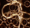 morgellons faser.jpg