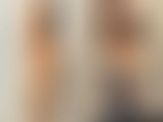 Side-by-side comparison of a woman's abdomen in black top pre- and post-procedure. Text reads: Actual Patient, Aloha Aesthetics MD LLC.