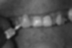 Shade take 4M1 B&W