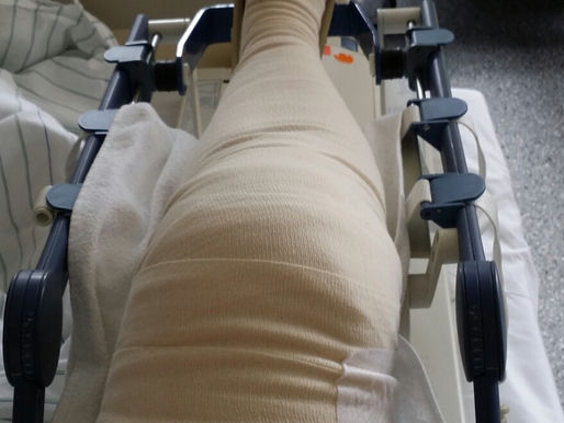 4. 06-2015 Operation Nr. 11 Knie rechts Arthrolyse in Heidelberg