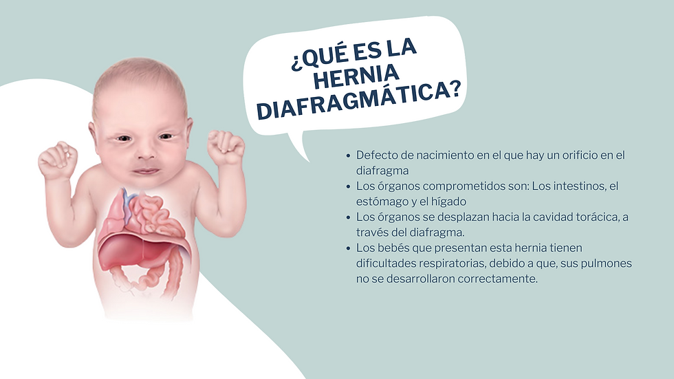 Definición