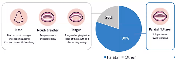 Laser therapy for Snore Treatment in San Antonio 