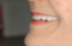After LeftSide
