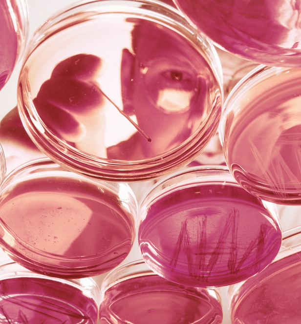 Petri Dishes_edited.jpg