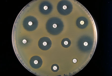 antibiotic picture.jpg