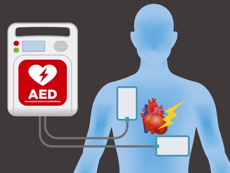 What Is an Automated External Defibrillator (AED)?
