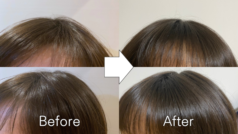 【スキャルプシャンプー】でツヤもボリュームも段違いにUP!!