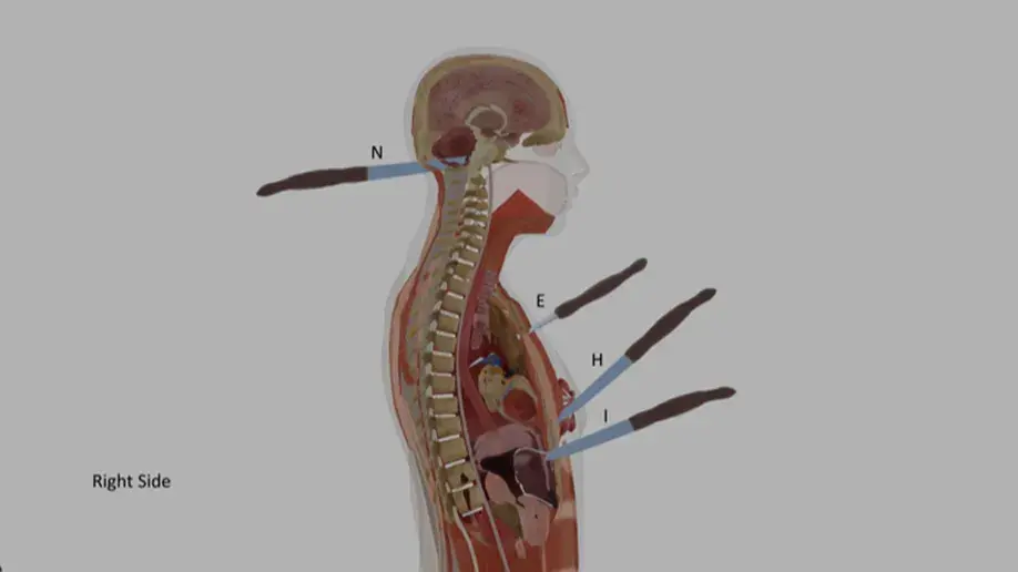 Ellen-Greenberg-suicide wounds rendering-1