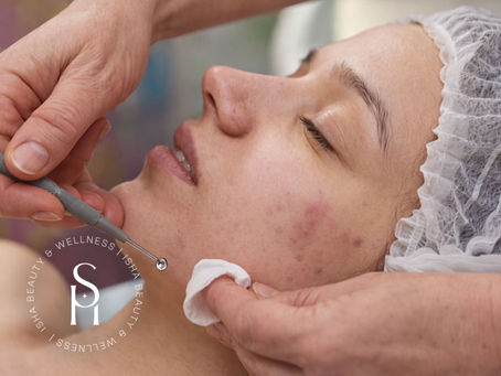 Aesthetician performing gentle extractions during an acne facial treatments