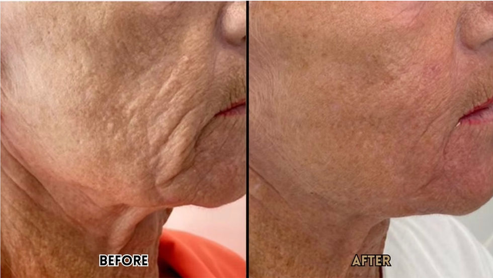 skin firming results sydney