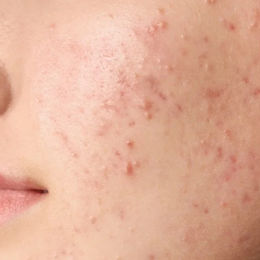 cosmetic clinic Norwest