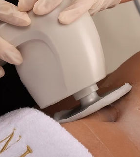 ultrasound fat melting