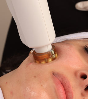 face sculpting treatment_edited_edited.j