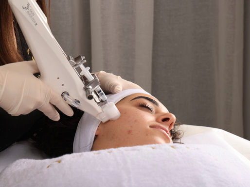Microneedling collagen induction skin texture Bella Vista Hills District