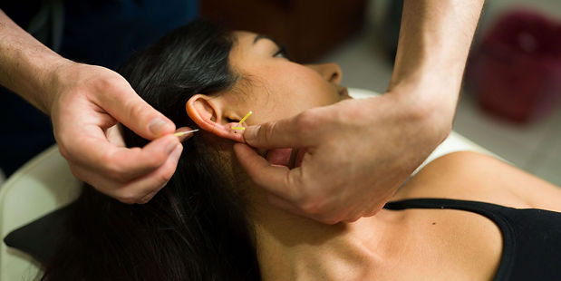 Acupuncture for Anxiety in Denver_edited.jpg