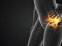 Sacroiliac Joint Dysfunction: Causes, Symptoms & Treatment