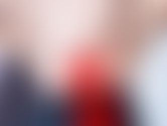 Facet Joint Sprain: Causes, Symptoms & Treatment