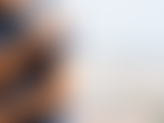 Upper Cross Syndrome: Causes, Symptoms & Treatments