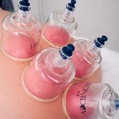 Cupping