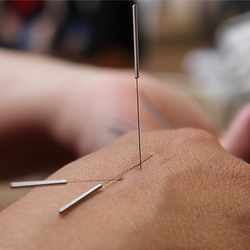 Hijamah | Bone Setting | Sports Massage