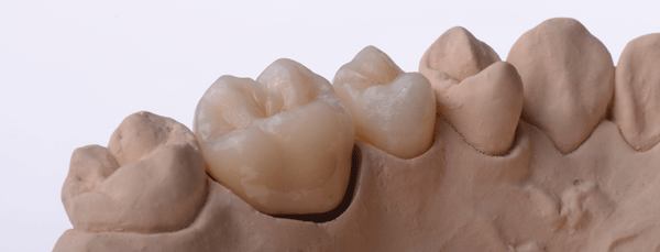 Molars