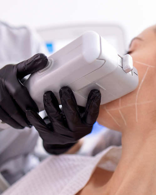 PHOTOS FOR FIVVER (3).png