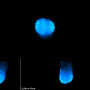 OUR map for HEALTH - Embryological Midline