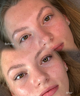 Before & after lashlift