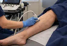 Illustrative close-up vascular ultrasound examination