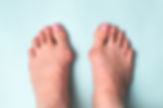 Nationa Bunion Day sponsored by Sole Bliss
