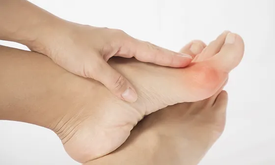 heels for bunions uk