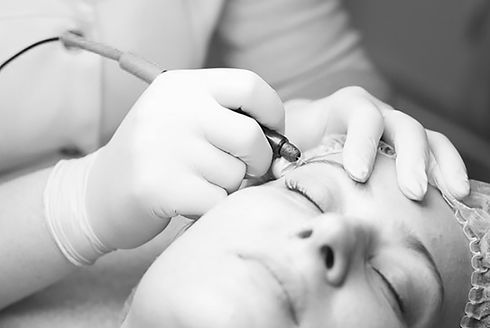 electrolysis-hair-removal.jpg