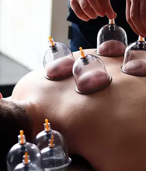 sessao-terapia-ventosas-copos-costas.webp