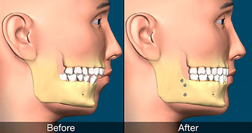 orthognathic.jpg