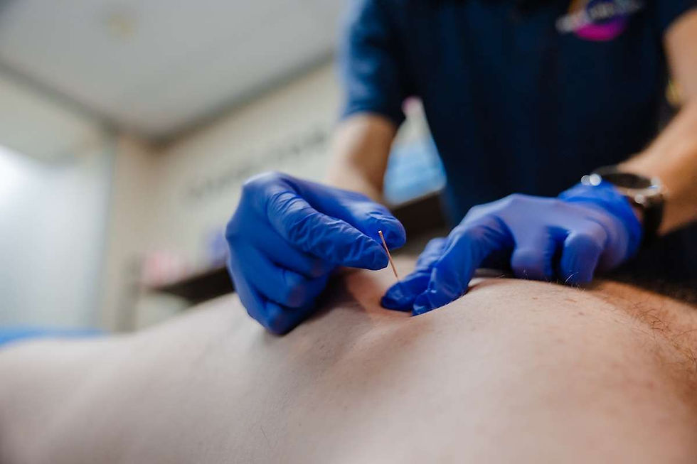 dry-needling-physiotherapy-1.jpg