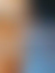 Tummy Tuck in Tijuana: Redefine Your Waistline with Natural Precision by Dr. Jorge Díaz