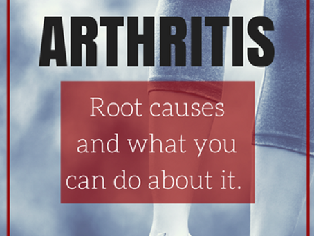 Arthritis
