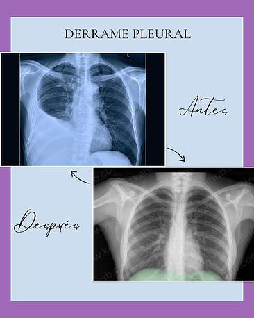 Posr de instagram (45) antes y despues odontoogia elegante profesional azul y blanco.jpg
