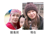 子宮頸頑疾用家分享.png