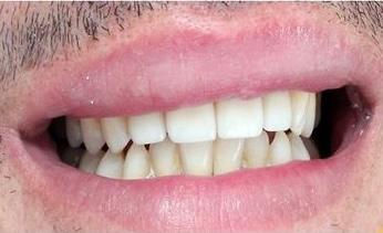 Bright, healthy smile after dental treatment