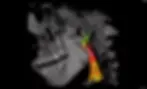 Etude-des-voies-respiratoires.webp